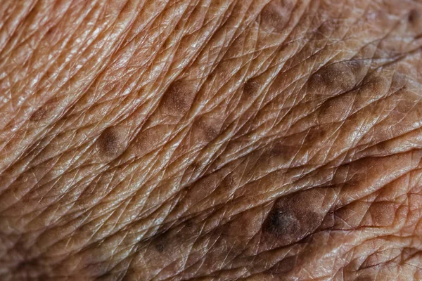 Close Shot Wrinkled Senior Skin People Hand Textures Old Skin — Stock Photo, Image