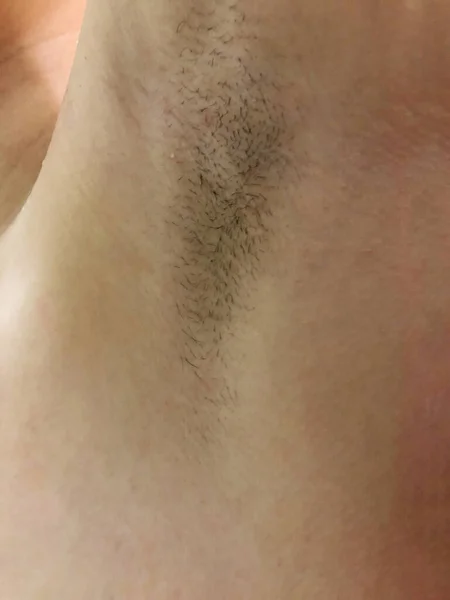 Armpit hair. Hairy female armpits. Body positive. — Stock Image Armpit hair. Hairy female armpits. Body positive. Stock Image