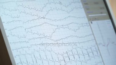 Genel olarak istasyonu monitör yoğun bakım ünitesinde hemşireler. EKG monitör ekran.