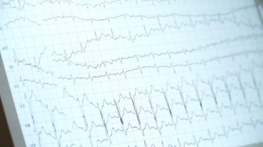 Genel olarak istasyonu monitör yoğun bakım ünitesinde hemşireler. EKG monitör ekran.