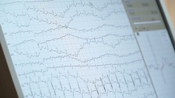 Celkové zdravotní sestry stanice monitor v jednotce intenzivní péče. Obrazovka monitoru EKG. — Stock video