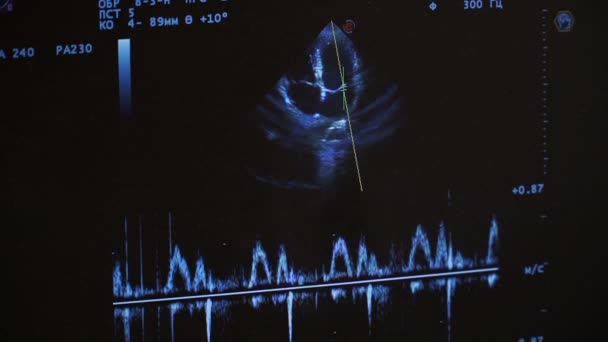 Ultrassom. Cardiologia. Monitore o ecrã de perto. Exame do coração com ultra-som. Médico cardiologista revisando paciente com ultra som . — Vídeo de Stock