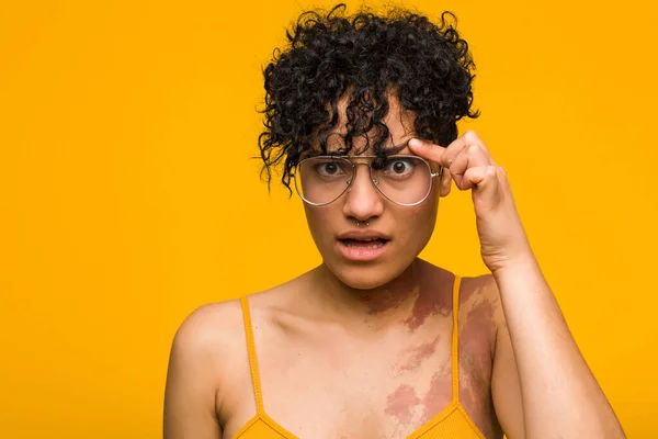 Mujer Afroamericana Joven Con Marca Nacimiento Piel Mostrando Gesto Decepcionante —  Fotos de Stock