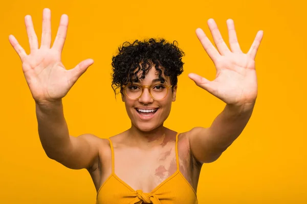 Young African American Woman Skin Birth Mark Showing Number Ten — Stock Photo, Image