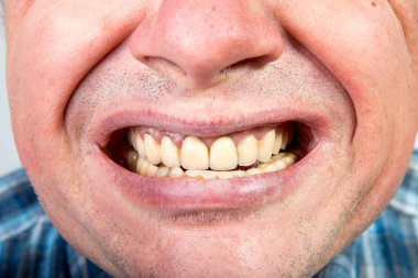 Yüzü salgın sırasında maske ile maskelendiği için orta yaşlı bir adamın yüzü diğerlerine görünmeyen farklı duygular. Salgın sırasında hiciv ve mizah