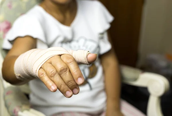 Woman sitting on a chair with Splint broken bone on her hand — Stock Photo, Image