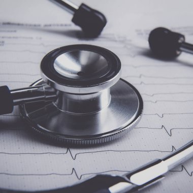 Masada yatan elektrokardiyogramda stetoskop.