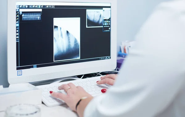 Lékařka, která se dívá na rentgeny a používá notebook v nemocnici — Stock fotografie