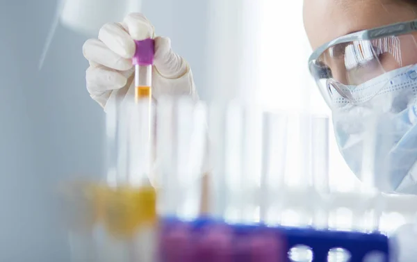 A medical or scientific researcher or doctor looking at a test tube of liquid green solution in a laboratory — Stock Photo, Image