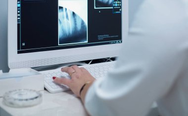 Kadın bir tıp doktoru röntgenlere bakıyor ve hastanede dizüstü bilgisayar kullanıyor.
