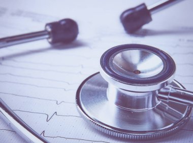 Masada yatan elektrokardiyogramda stetoskop.
