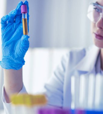 Laboratuvar asistanı bir kan örneğini analiz ediyor.