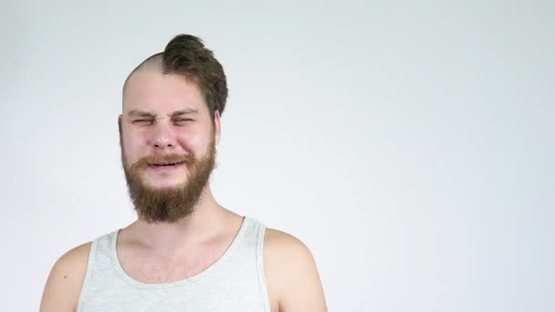 Halb glatzköpfige Menschen blicken in die Kamera und weinen.. — Stockvideo