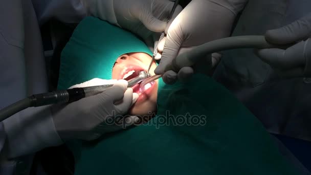 Kid having mouth checkup in dental clinic — Stock Video