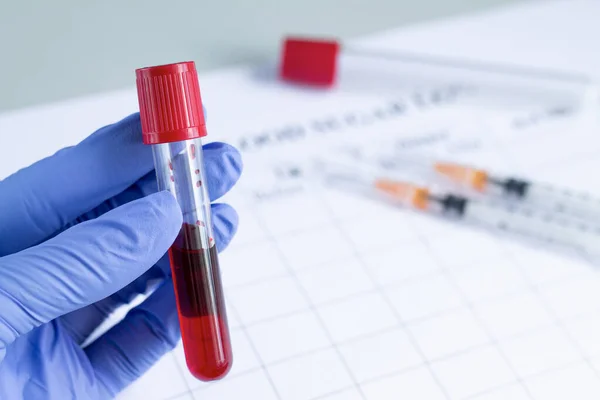 Doktorun eli, kırmızı kan plazması test için hazır olan test tüpünü tutuyor. Tıp laboratuarı tanı konsepti