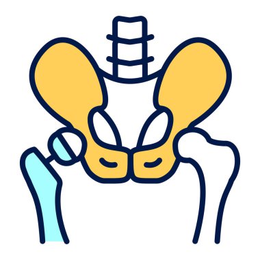 Eklembacaklı çizgi renk simgesi. Leğen kemiğine kalça protezi takıldı. İzole vektör ögesi. 