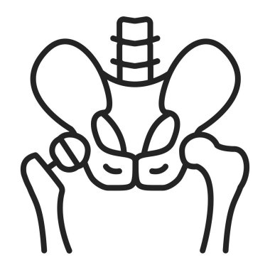 Eklembacaklı siyah simge. Leğen kemiğine kalça protezi takıldı. İzole vektör ögesi. 