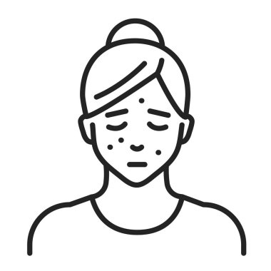 Yüz kızarıklığı çizgisi siyah ikonu. Dermatolojik hastalıklar. İzole vektör elementi. Web sayfası, mobil uygulama, tanıtım için resim çizelgesi.