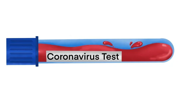 Coronavirus Covid Εξέταση Αίματος Αίμα Στο Σωλήνα Λευκό Φόντο Πρόληψη — Φωτογραφία Αρχείου