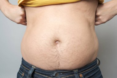 Adam şişmanlığını karnında gösteriyor.