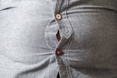 Kilolu bir adam. Bira göbeği kavramı