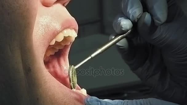 Man gets dentist medical mouth teeth treatment — Stock Video
