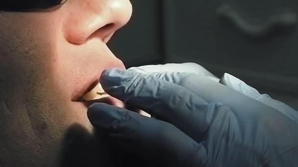 Человек получает стоматолога лечение зубов во рту — стоковое видео