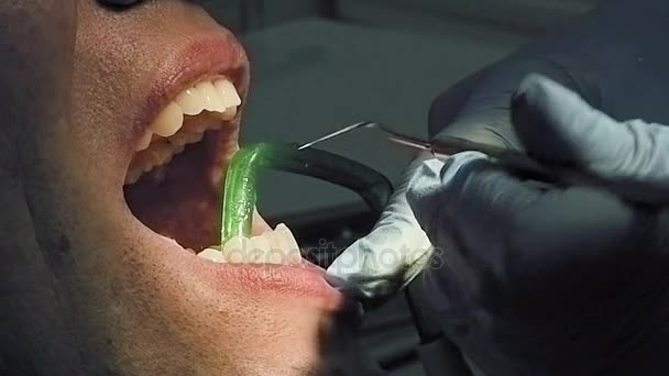 Man får tandvård medicinsk undersökning och behandling — Stockvideo