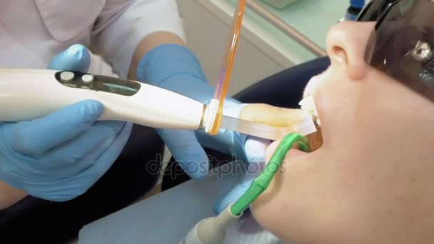 La mujer recibe ayuda dental para llenar una cavidad en un diente — Vídeos de Stock