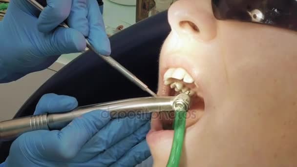 Femme à la clinique médicale du dentiste pour le traitement — Video