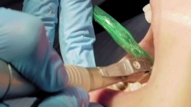 Mulher na clínica médica higienista dentária — Vídeo de Stock