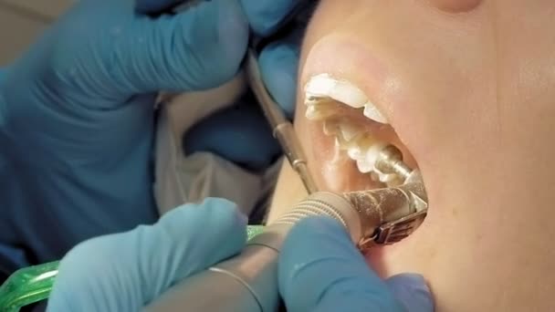 Женщина в стоматологической гигиенической клинике — стоковое видео