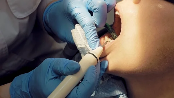 Nainen ultraääni hammas plakin odontolith poistamalla — kuvapankkivalokuva