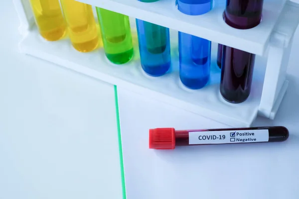 Covid-19 blood test tubes with positive results label placed on paper  clip board at table of laboratory.