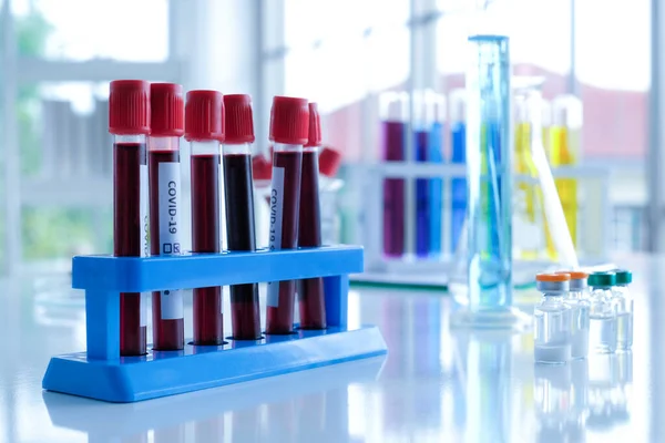 Covid-19 kan testi tüpleri ve aşı örnek şişeleri araştırma laboratuarında test tüpleri ile birlikte..