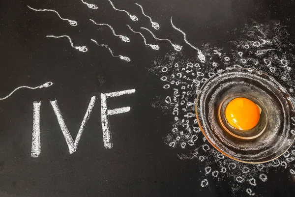 Ivf Concept Eieren Sperma Een Zwart Krijtbord Getekend Krijt Een — Stockfoto