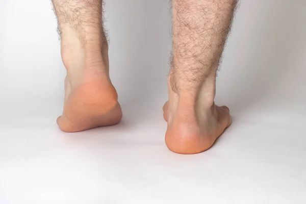 Bare Hairy Male Legs Feet Heels White Background Achilles Tendon — Stock Photo, Image