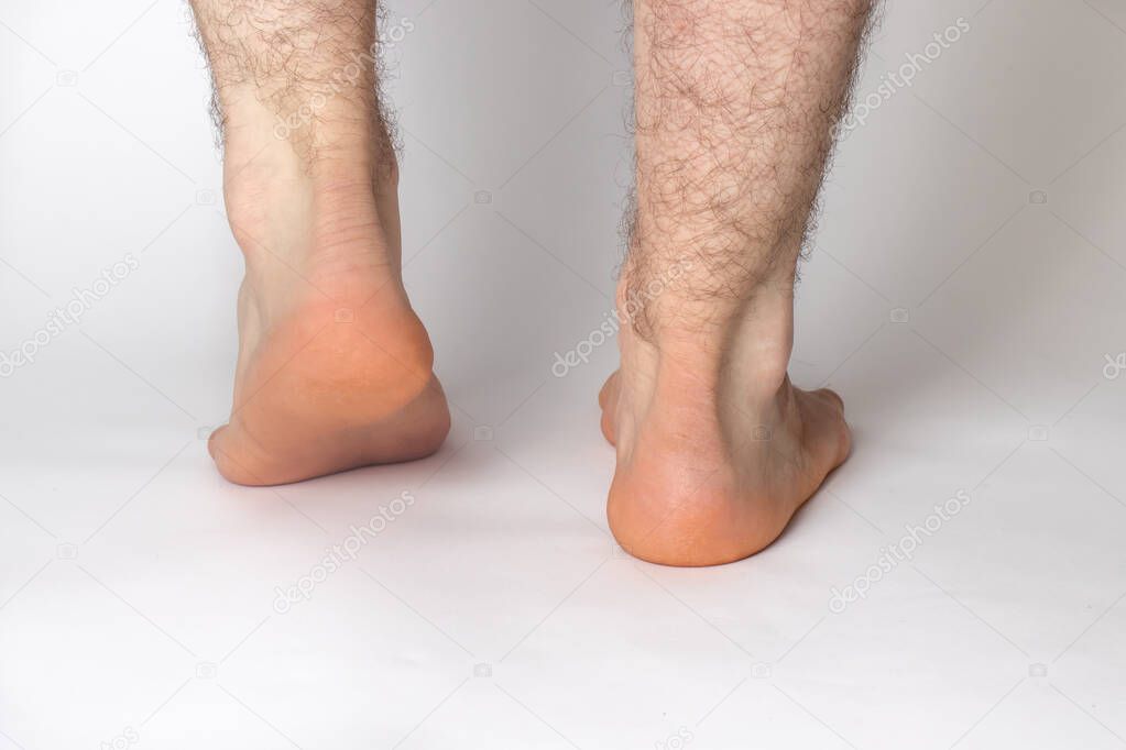 Bare hairy male legs, feet, heels on a white background. Achilles tendon.