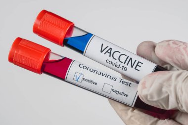 İçinde kan örneği olan vakum tüpleri Covid-19 enfeksiyonu için pozitif sonuç veriyor ve elinde beyaz arka planda tıbbi eldiven bulunan mavi renk aşısı örneği var.