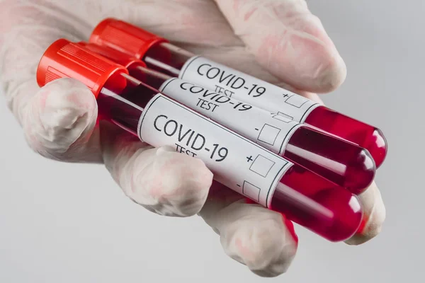 Několik Vakuové Trubice Vzorkem Krve Pozitivním Výsledkem Covid Infekce Ruce — Stock fotografie