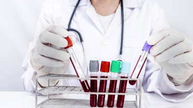 Bir doktor beyaz arka plandaki tüplerden alınan kan testlerini test ediyor.