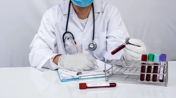 Bir doktor beyaz arka plandaki tüplerden alınan kan testlerini test ediyor.