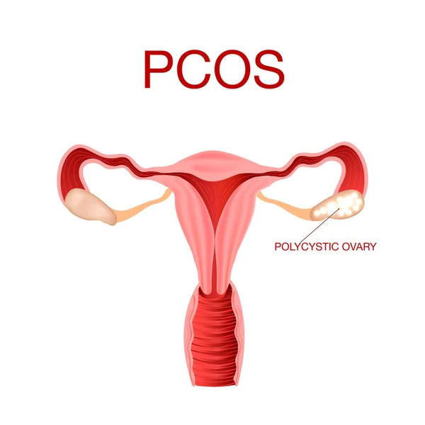 Realistic human internal organ uterus vector design illustration — Stock Vector