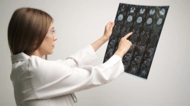 Hastanedeki doktor kafasının röntgenini tutuyor..