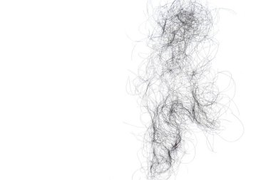 Saç dökülme sorunları çok fazla.