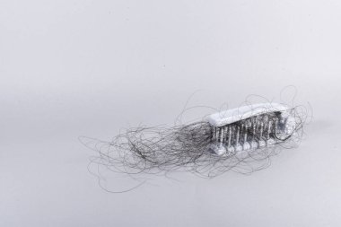 Saç dökülme sorunları çok fazla.