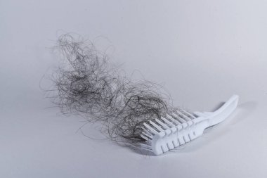 Saç dökülme sorunları çok fazla.