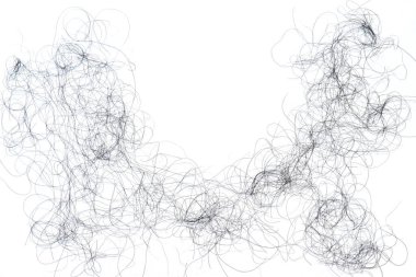 Saç dökülme sorunları çok fazla.