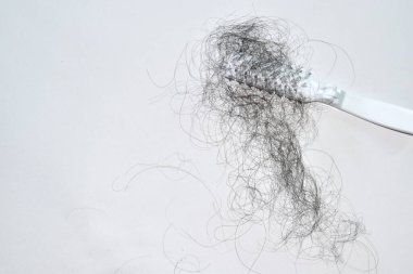 Saç dökülme sorunları çok fazla.