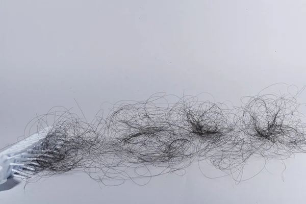 Saç dökülme sorunları çok fazla.